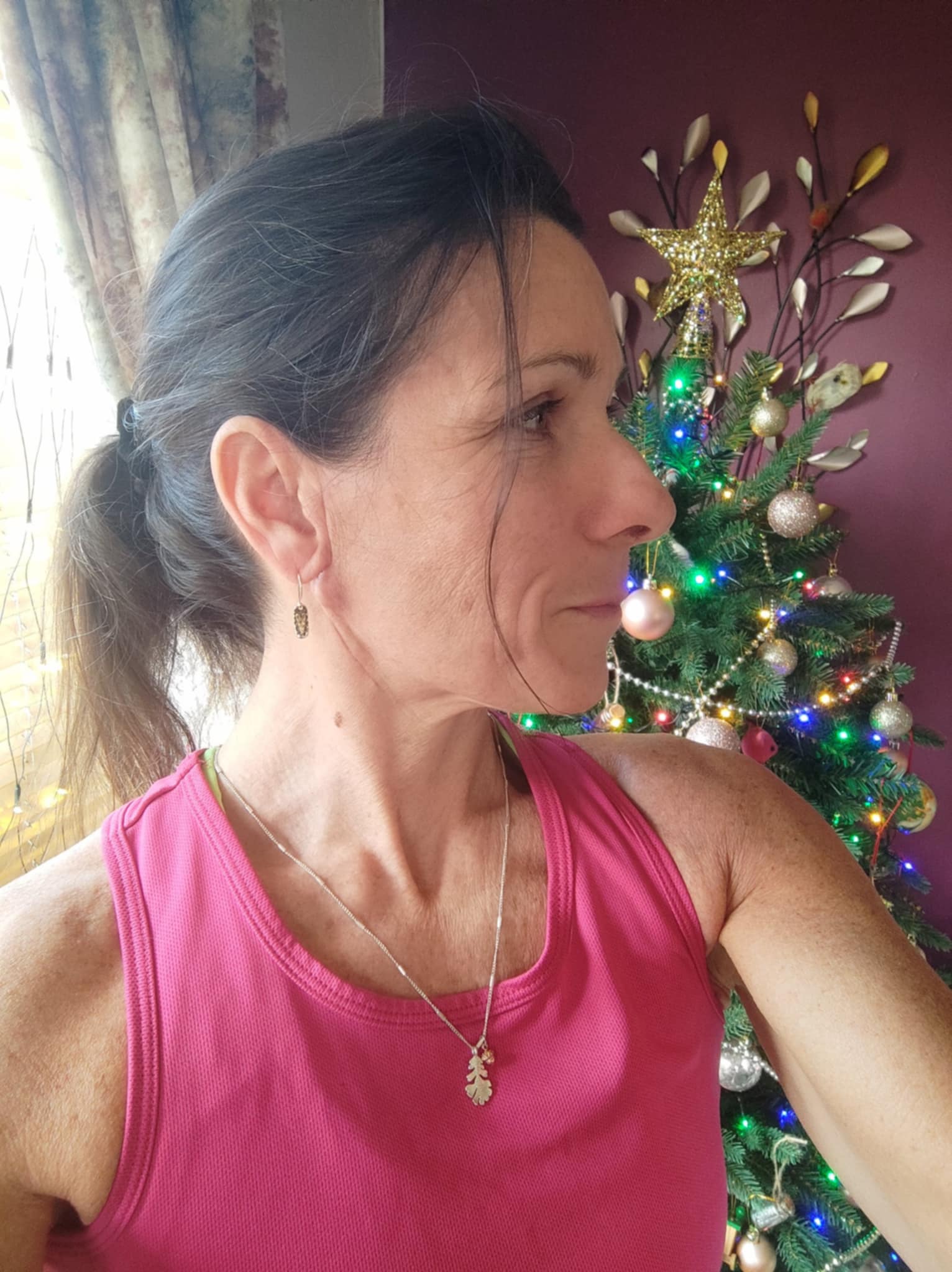Lisa showing her healed scar, with Christmas tree in background - a symbol of renewal and celebration