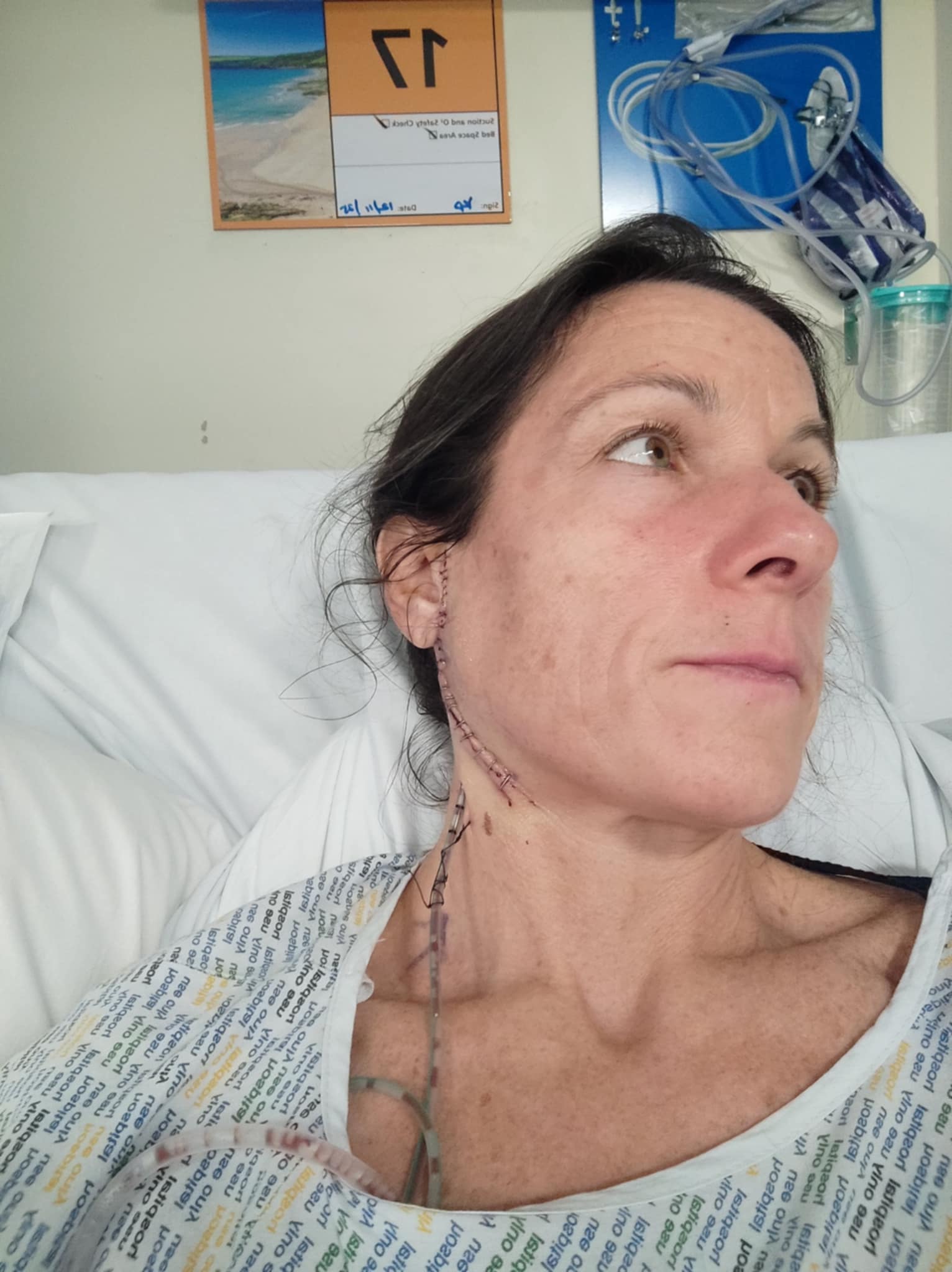 Lisa recovering in hospital showing surgical wound